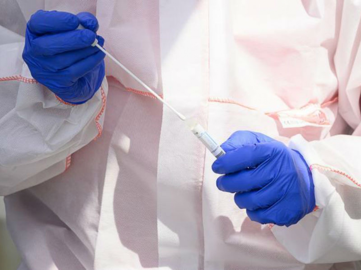 Новые случаи коронавируса нашли в 26 муниципалитетах Кубани